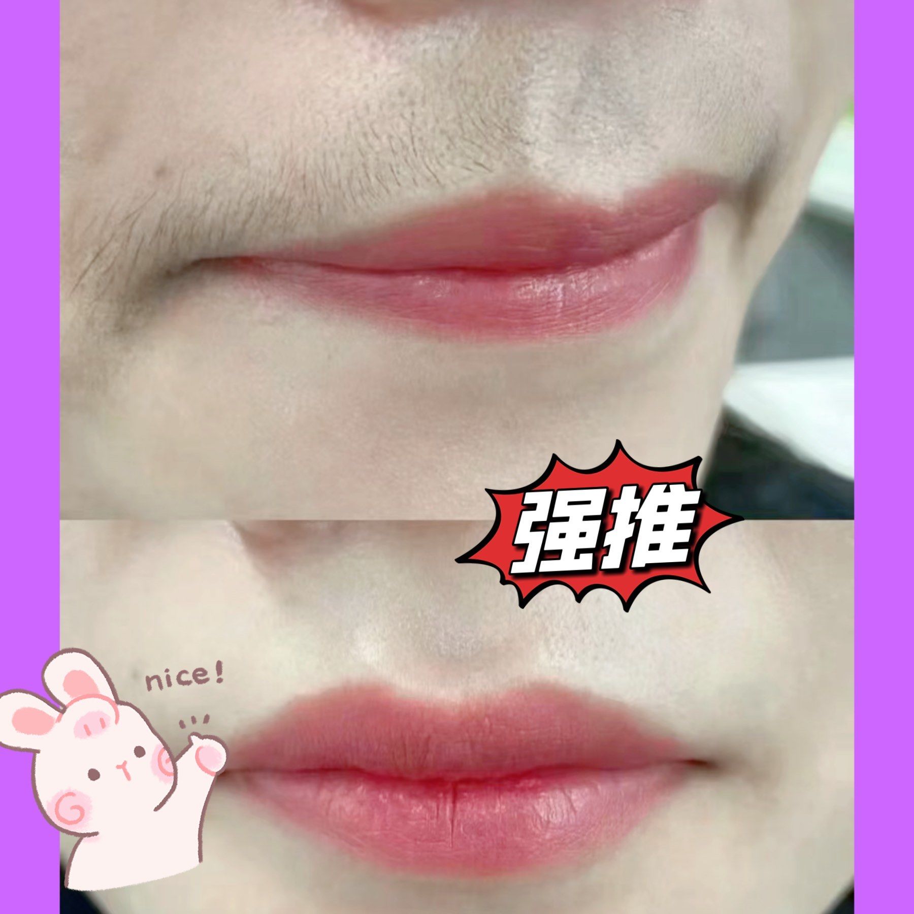 唇部脱毛效果对比90超干净[胜利][胜利][胜利]