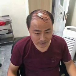 -发饰美男士增发补发假发定制店