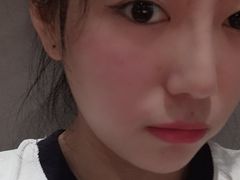 -黑马眼科·近视手术