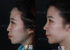 -北京米扬丽格医疗美容·联合丽格鼻整形中心