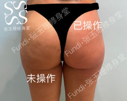 -Fundi张玉珊修身堂·indiba·BTL科技瘦身