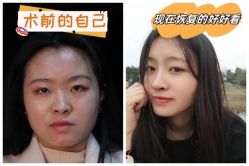 -素美医疗美容·西南眼鼻整形·修复基地