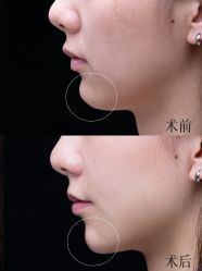 -深圳艺星医疗美容医院