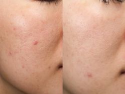 -深圳芙必优医疗美容·抗衰中心