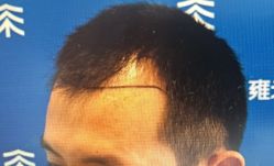 -雍禾植发全国连锁