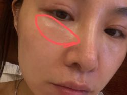 -广州美莱医疗美容医院