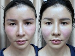 -深圳艺星医疗美容医院