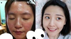 -SKINIST丽铂医疗美容