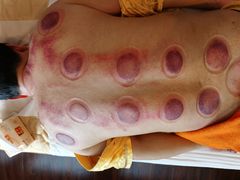 -脊艾堂推拿·艾灸(美年广场店)