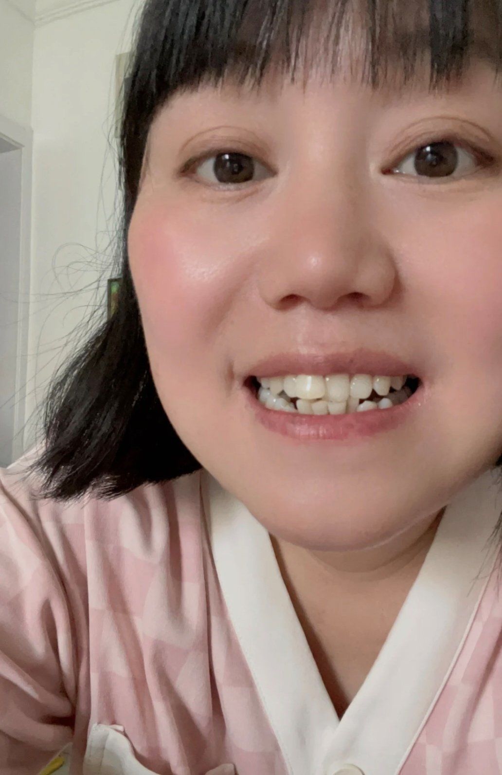 只有一颗牙不齐怎么矫正啊?