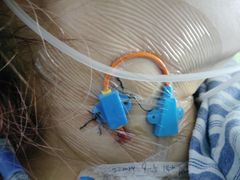 -清华大学玉泉医院