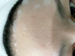 -弘美医美·艾维岚童颜抗衰中心