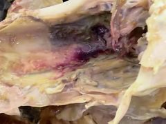 -窑鸡王(罗湖口岸店)