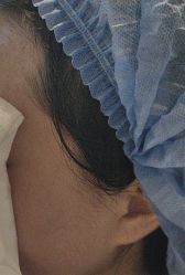 -四川米兰柏羽医学美容医院