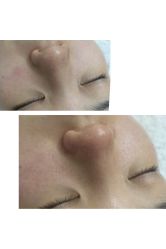 -肌理言健康美肌驻颜所