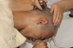 点击看大图 -大麦微针植发丨全国连锁