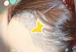 -大麦微针植发全国连锁