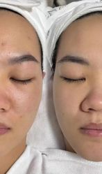 点击看大图 -SKIN79皮肤管理中心