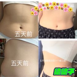 -Fundi张玉珊修身堂·indiba·BTL科技瘦身