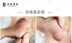 -S庆熙美学皮肤管理
