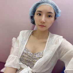 体验后-依萱绮医疗美容
