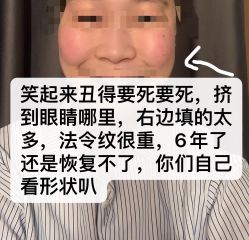 体验后-北京炫美医疗美容