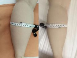 -Lily纤美·科技减脂中心