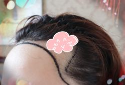 -大麦微针植发全国连锁