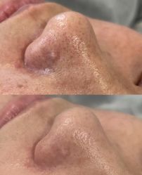 -SKIN79皮肤管理中心