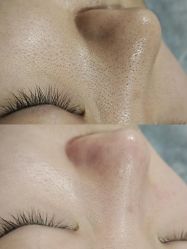 -SKIN79皮肤管理中心