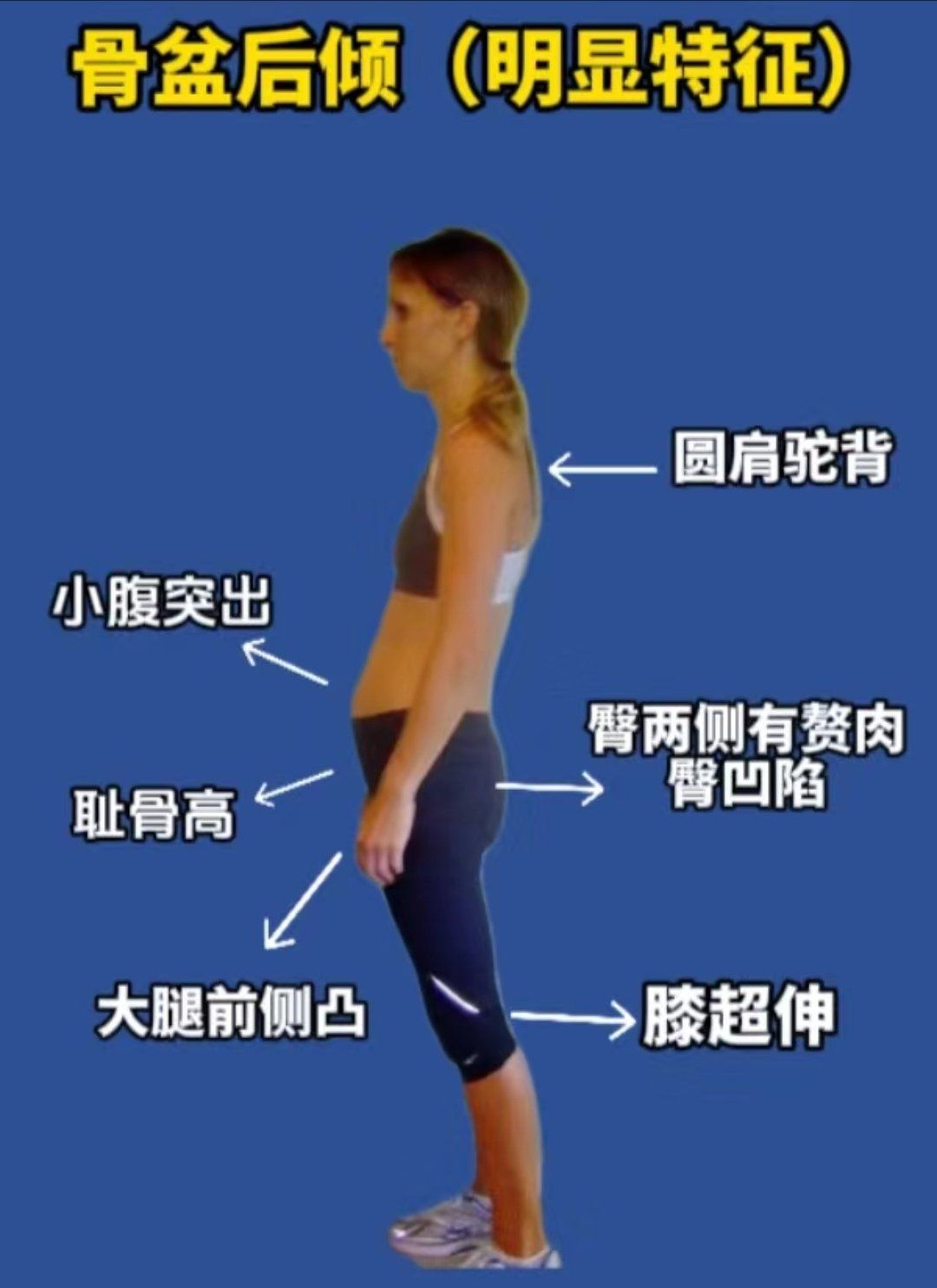 体态调整