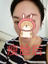 体验后-北京丽星翼美医疗美容