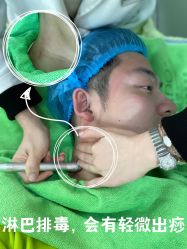 -清颜堂专业祛痘