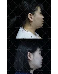 -洁铭新加坡医美