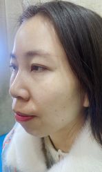 体验前-重庆联合丽格第五医疗美容医院