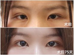 点击看大图 -丰联丽格医疗美容·联合丽格眼整形中心