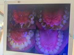 -爱牙联合口腔(门诊报销 海云庵店)