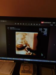 -重庆安琪儿妇产医院-妇幼保健联盟医院