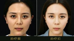 -美莱医学美容医院