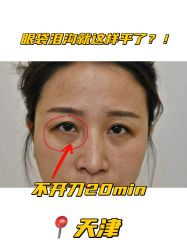 -天津健丽·去眼袋医疗美容机构