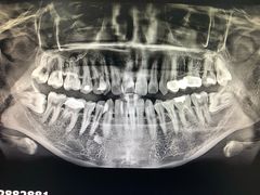 -上海市杨浦区牙病防治所