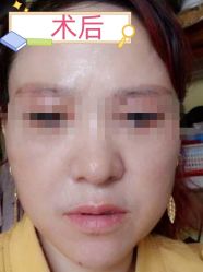 -素美医疗美容·西南眼鼻整形·修复基地