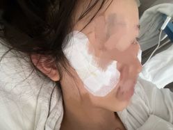 体验后-上海首尔丽格医疗美容医院