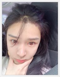 -大麦微针植发全国连锁