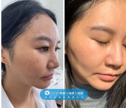 -巧兮美学半永久纹绣·纹眉·纹唇