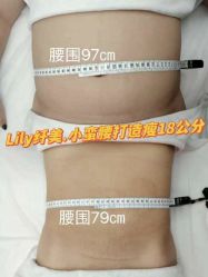 -Lily纤美·科技减脂中心