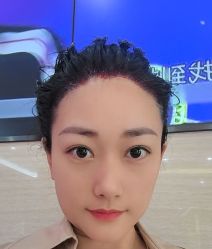 -大麦微针植发丨全国连锁