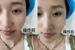 -坤如玛丽·医疗美容中心