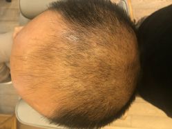 -乐绅男士高端假发定制