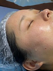 -长沙雅美医疗美容医院